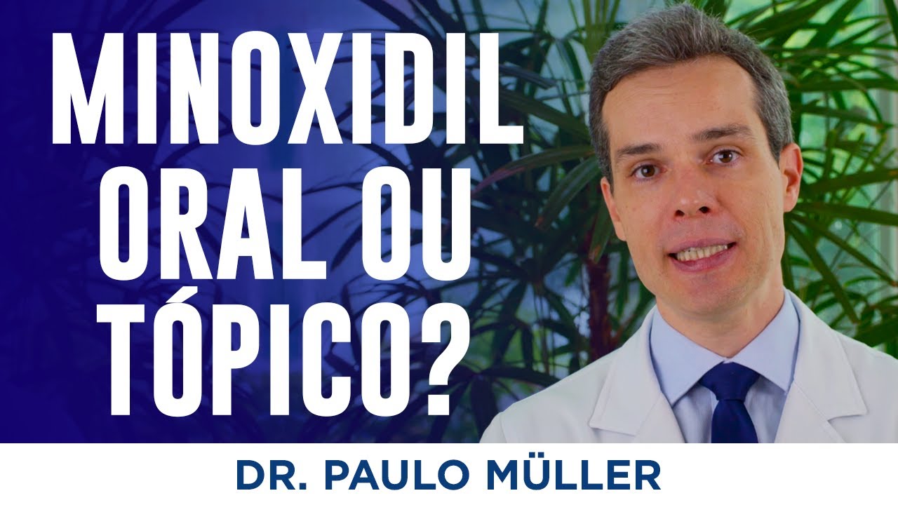 O que é Melhor para Queda de Cabelo, Minoxidil Oral ou Minoxidil Tópico? – Dr. Paulo Müller