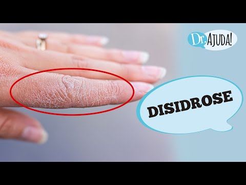 Disidrose: o que é, sintomas, causas e tratamento - Brasil Acontece