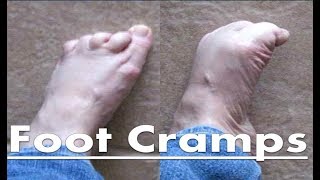 Foot Cramps at Night - The Home Treatment Guide!