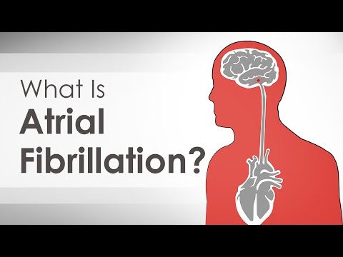 A Patient's Guide to Living With Atrial Fibrillation
