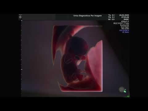 Ultrassom 4D em feto de 11 semanas