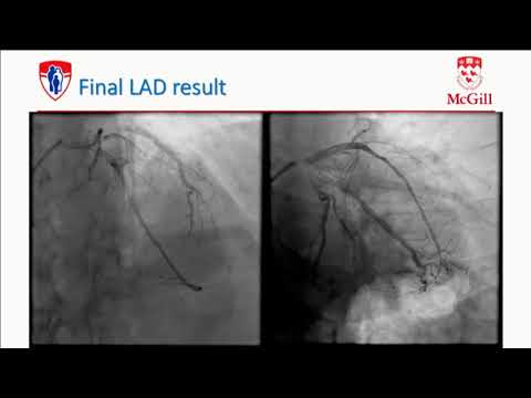 The Hybrid Approach - Stéphane Rinfret, MD