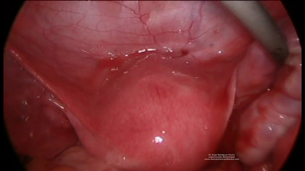 Jorge Alberto Rodriguez Pezino-67