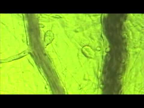 Miniatura filmu: efekt sygnału BEMER