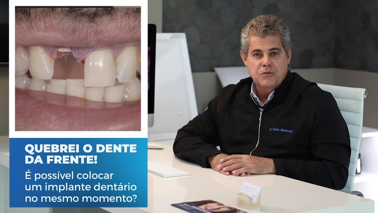 Quebrei o dente da frente, o que fazer? Dr. Cláudio Albuquerque responde