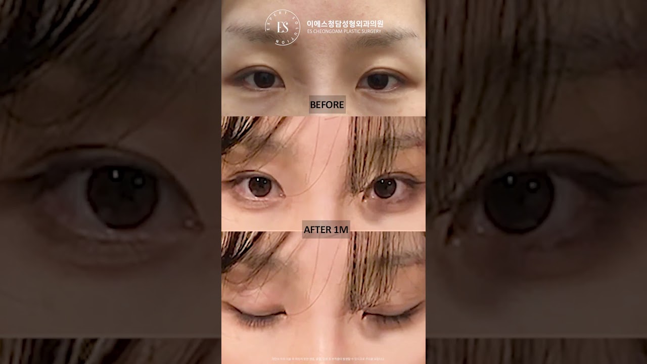 이에스 유튜브