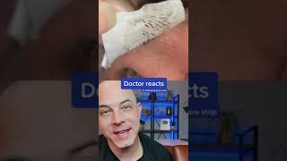 Derm reacts to incredibly satisfying pore strip removal! #dermreacts #porestrip #blackheads