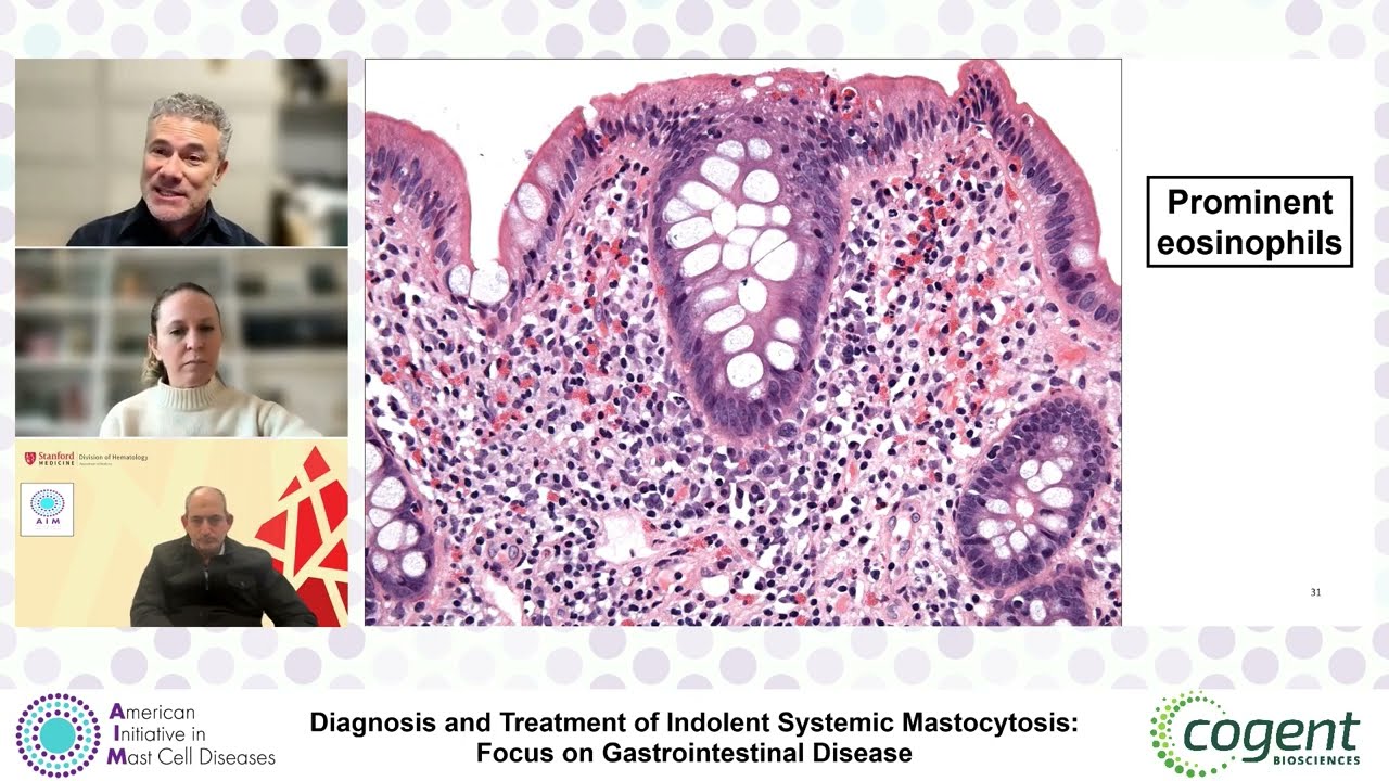 Diagnosis and Treatment of Indolent Systemic Mastocytosis:  Focus on Gastrointestinal Disease