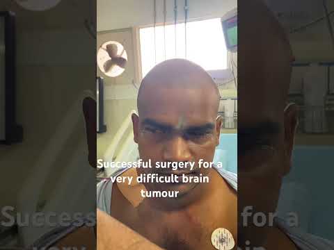 Treatment of Brain Tumor | Brain operation | Neurosurgeon in Meerut