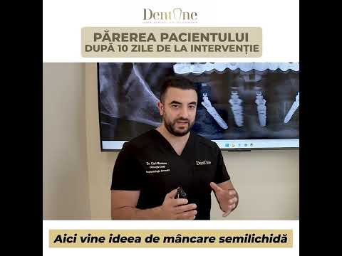 Implanturi dentare cu aditie osoasă complexă