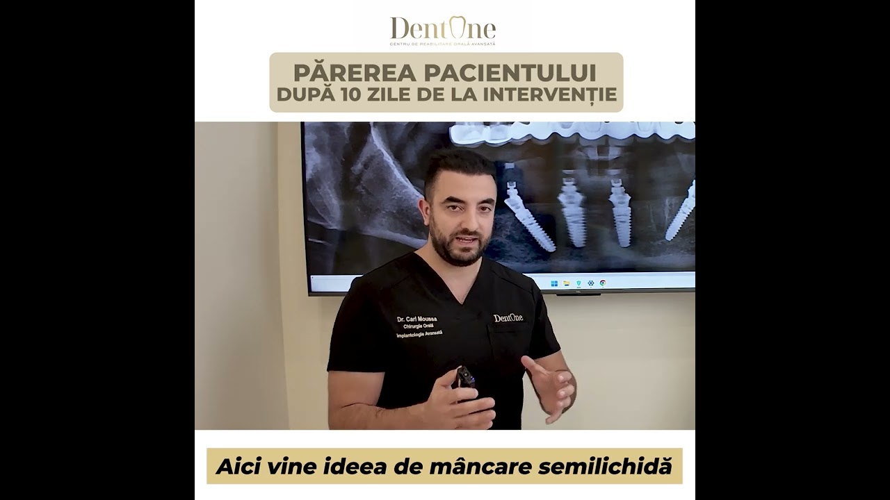 Implanturi dentare cu aditie osoasă complexă – Caz de forță majoră, soluție garantată!