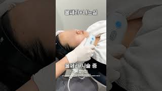 울쎄라피프라임+나노실 후기