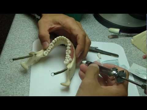 Intraosseous Anesthesia - Stabident/XTip