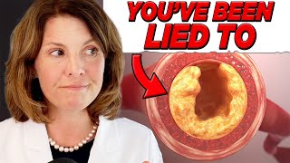 Why I don't prescribe statins for high LDL cholesterol