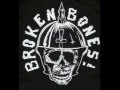 Broken Bones -  Annihilation No 3