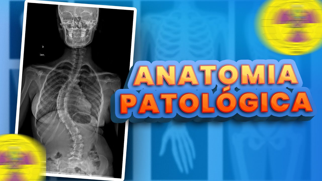 O Que é Anatomia Patologica O Que é Anatomia Patologica