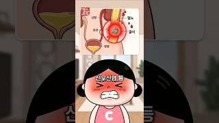 복통 아픈 위치 보면 병이 보인다? 맹장염, 신장결석 응급신호 #shorts #건강정보 [2편]