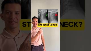 Straight neck away! #neckpain #stiffneck #headache