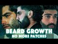 Grow A FULL BEARD In 7 Days No More Patches Extreme Subliminal Activation