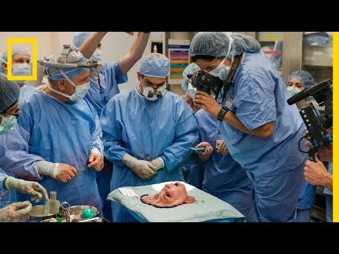 Le nouveau visage de Katie : l'histoire d'une greffe totale du visage