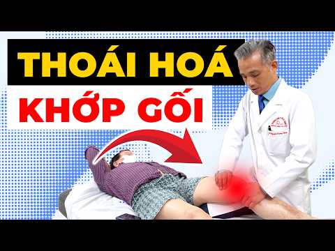Thoái Hóa Khớp Gối: Đừng chờ đau mới chữa – Harvard cảnh báo điều này!