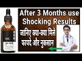 Thrive Hair Growth Serum Thrive Hair Growth Serum Review Thriveco Hair Serum Review