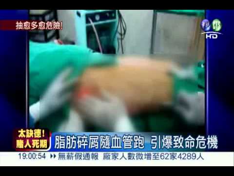 抽脂有風險! 脂肪碎屑感染恐致命