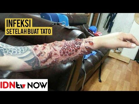 Menghapus perut tanpa otot Apakah Volcano belt menghilangkan lemak perut