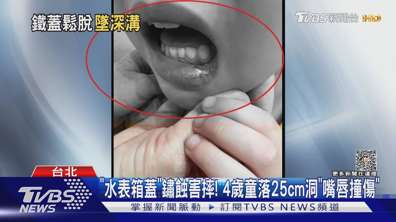 「水表箱蓋」鏽蝕害摔! 4歲童落25cm洞「嘴唇撞傷」