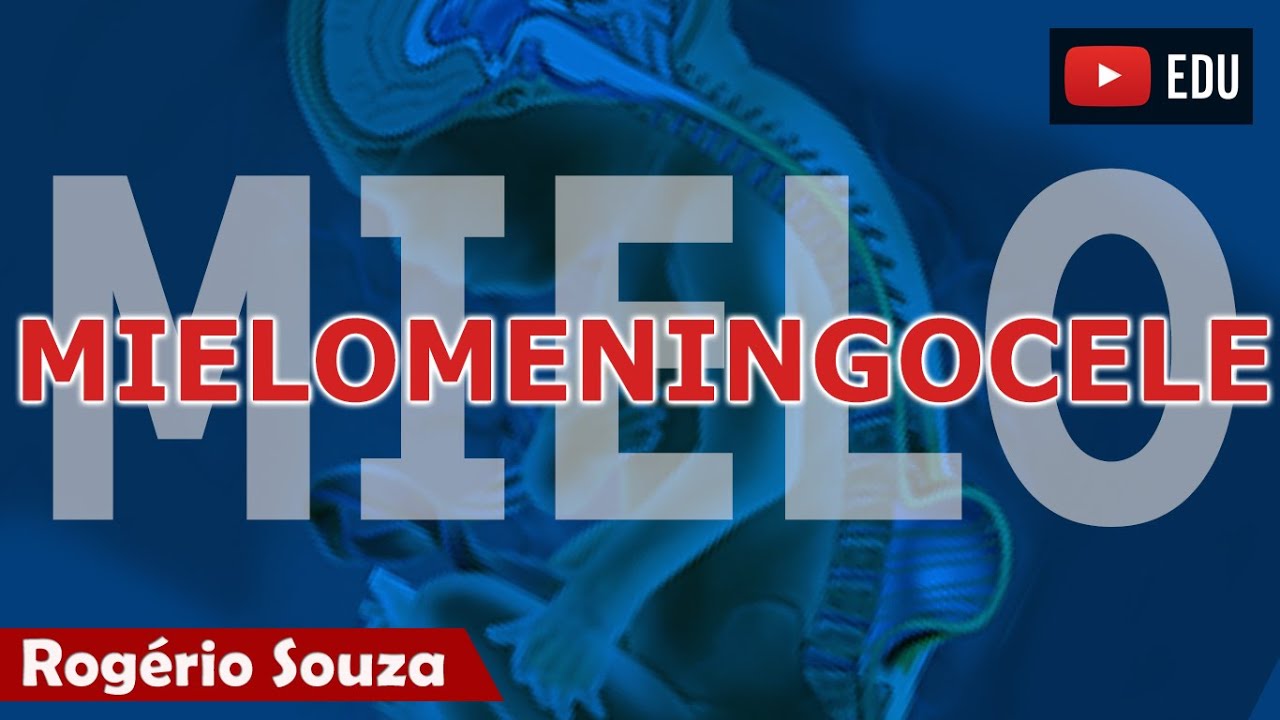 MIELOMENINGOCELE (Aula Completa) - Rogério Souza (2/2)
