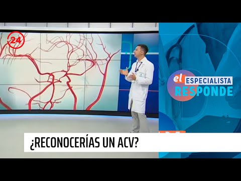 El Especialista responde: ¿Reconocerías un ataque cerebrovascular?