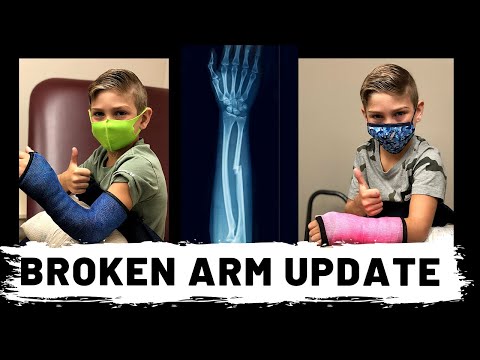 UPDATE | Broken Arm! EMERGENCY!