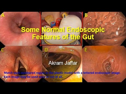 Anatomía del tracto gastrointestinal en endoscopia