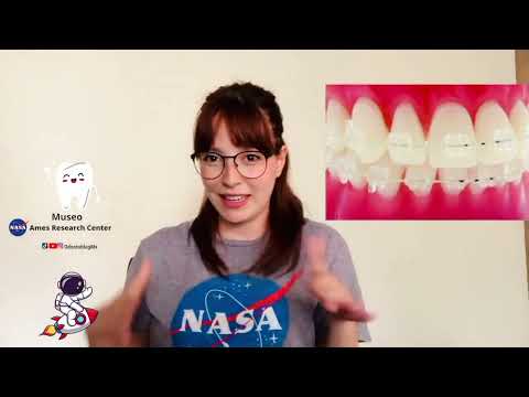 ¿La NASA inventó los brackets?
