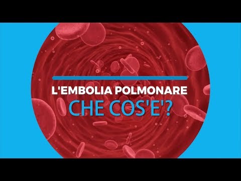 PRIMA PUNTATA: L'embolia polmonare: che cos'è?
