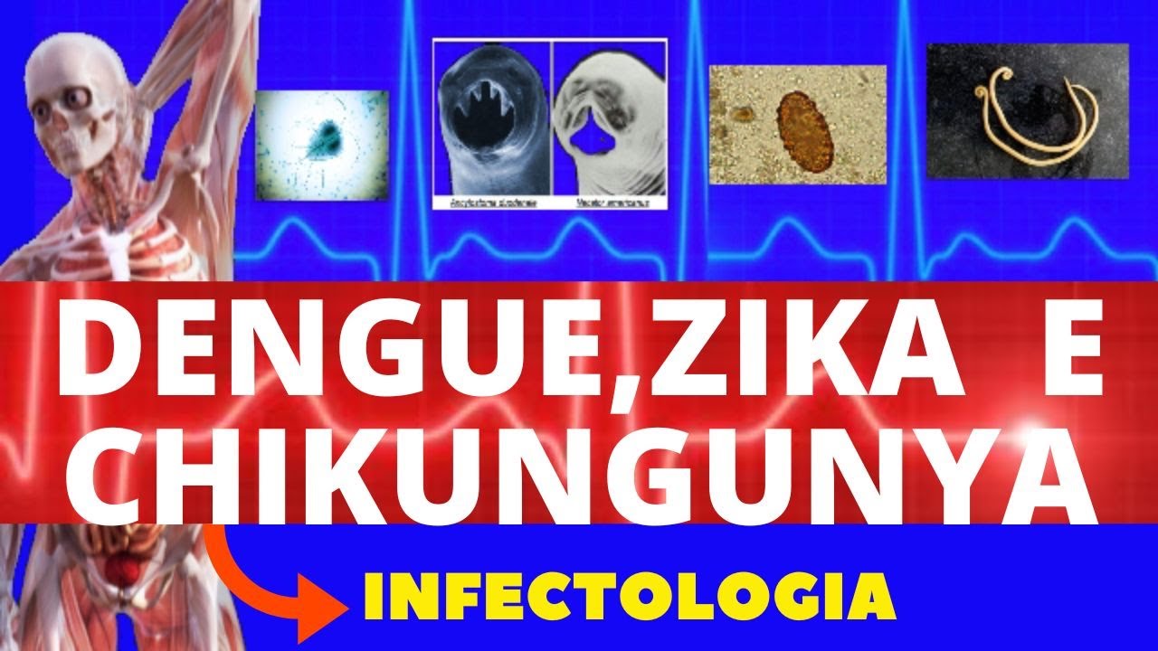 ZIKA, DENGUE E CHIKUNGUNYA - CAUSAS, SINTOMAS, DIAGNÓSTICO E TRATAMENTO - INFECTOLOGIA
