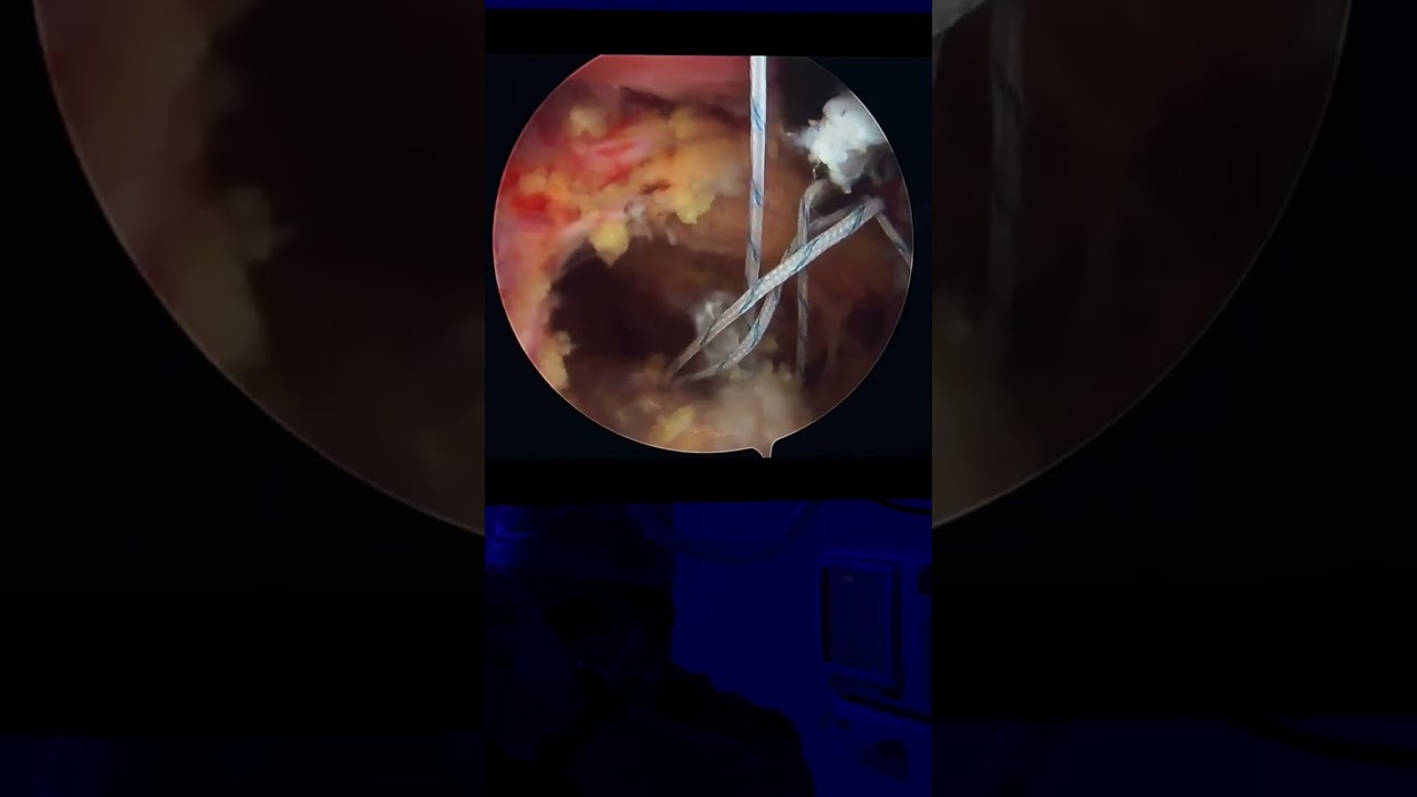 Luis Alfredo Miranda Ocaña-19