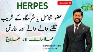 Download lagu Nafs Ke Dane Aur Zakham Wali Kharish Ka Ilaj | Nafs Ke Dano ka ilaj | Private Part itching mp3