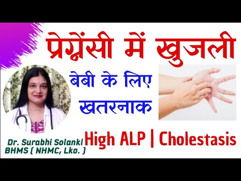 Pregnancy me khujli kyon hoti hai | Alkaline phosphatase ALP high in pregnancy | Cholestasis