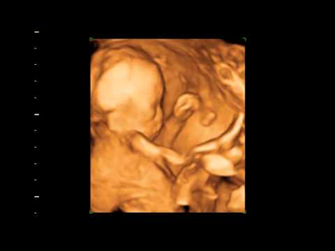 Click to Watch the Priests for Life Supporting Albuquerque Efforts and Beyond To Protect Pain-Capable Children video