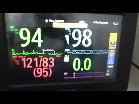 Philips IntelliVue MX400