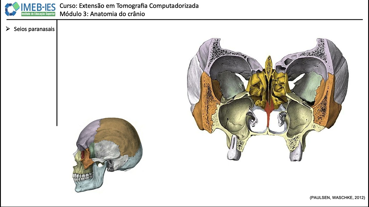 seios paranasais   anatomia