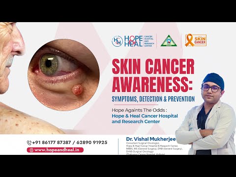Skin Cancer Awareness with Dr. Vishal Mukherjee | Hope & Heal