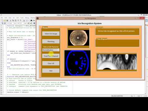 Iris Recognition System Using Matlab Project Source Code Iris Recognition Using Image Processing