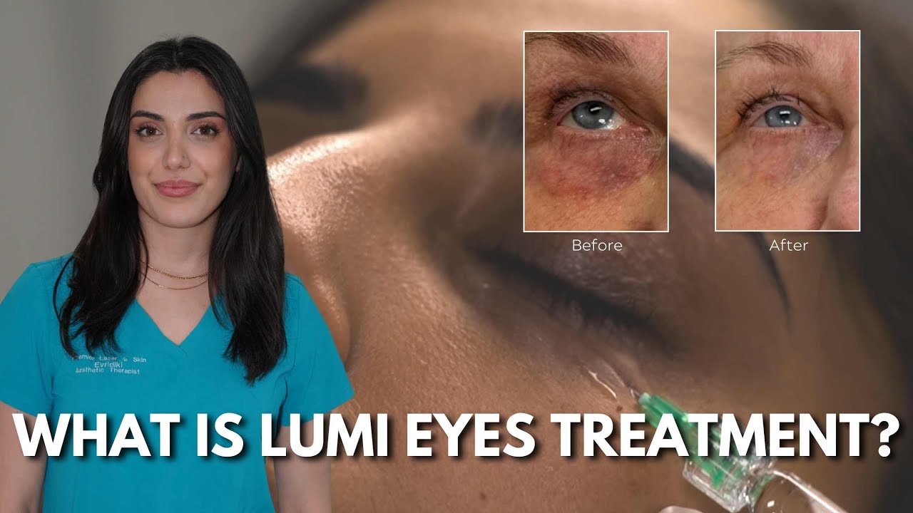 Tired Eyes? This Treatment Will Make You Look YEARS Younger!