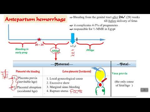 Antepartum hemorrhage / part 1