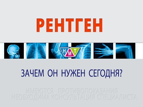 Боли в спине после спорта 35 неделя боли в пояснице
