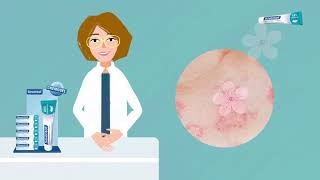 Anwendung Soventol HydroCort 02.21