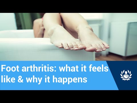 Arthritis in the foot (big toe) || What it feels like & why it happens