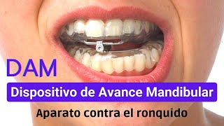 DAM: Dispositivo de Avance Mandibular para corregir el RONQUIDO